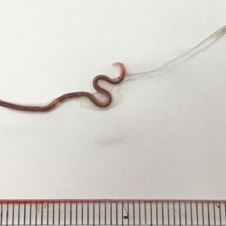 Doctors pull 1.5-inch worm from woman’s tonsils after she ate sashimi