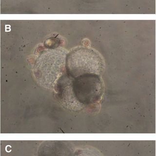 Extensive morphological variability in asexually produced planktic foraminifera