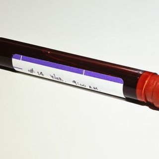 Experimental Blood Test Detects Cancer up to Four Years before Symptoms Appear