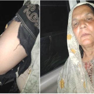 Pakistan: Man shares pictures of injured mother, relatives after Sheikhupura police brutally thrash family