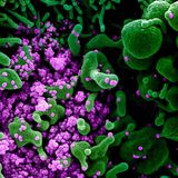 Common cold viruses can spark response against the coronavirus, San Diego scientists report