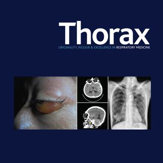 SARS-CoV-2 seroprevalence and asymptomatic viral carriage in healthcare workers: a cross-sectional study