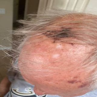 Police: 77-year-old veteran attacked for wearing MAGA hat