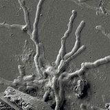 Scientists find intact brain cells in skull of man killed in Vesuvius eruption nearly 2,000 years ago | CNN