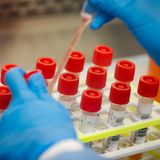 Understanding the difference between rapid antigen and PCR tests