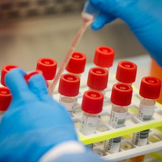 Understanding the difference between rapid antigen and PCR tests