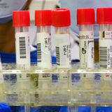 Why isn't coronavirus testing increasing in the United States?