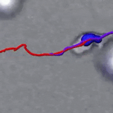 Eerie Footage Captures Human Immune Cells Digging a Tunnel Through Tissue