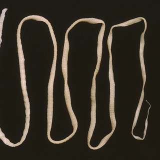 Brain-Invading Tapeworm That Eluded Doctors Spotted by New DNA Test