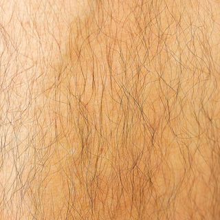 Kids that accidentally grew thick body hair can’t find a cure