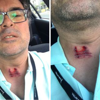 An LAist Reporter Was Hit By A Police Projectile. LBPD Says The Incident Was Within Police Policy