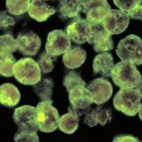 Deadly 'Brain-Eating' Amoeba Slowly But Surely Expanding Its Footprint in The US