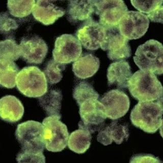 Deadly 'Brain-Eating' Amoeba Slowly But Surely Expanding Its Footprint in The US