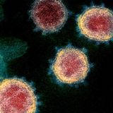 Nebraska records third coronavirus death, a Lincoln County man in his 90s