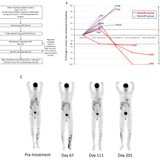 Fecal microbiota transplant promotes response in immunotherapy-refractory melanoma patients