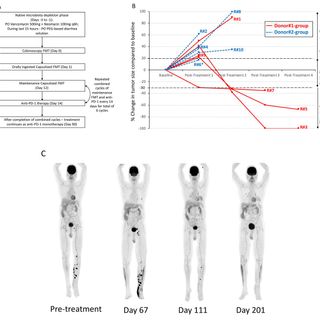 Fecal microbiota transplant promotes response in immunotherapy-refractory melanoma patients