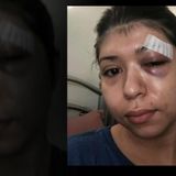 College student attacked with crowbar in attempted Brighton Park carjacking: 'I still can't believe I'm alive'