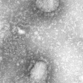 Three being monitored for coronavirus in North Dakota