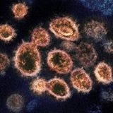 Virus variant from South Africa detected in US for 1st time