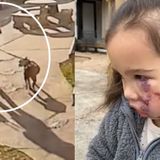 Hearing held to determine fate of dog that attacked 3-year-old girl at restaurant