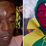 Lil Uzi Vert's $24 million diamond forehead implant makes him look like Marvel's Vision