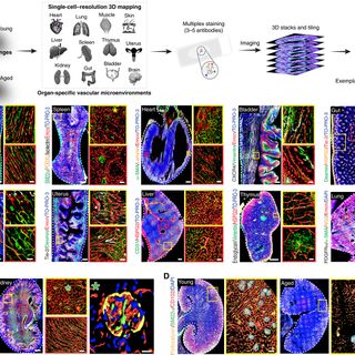 High-resolution 3D imaging uncovers organ-specific vascular control of tissue aging