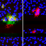 SARS-CoV-2 with Genomic Deletions Escapes an Antibody