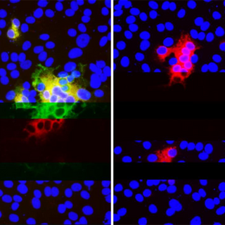 SARS-CoV-2 with Genomic Deletions Escapes an Antibody