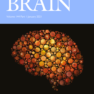 How do the blind ‘see’? The role of spontaneous brain activity in self-generated perception