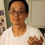 An Asian-American man suffers a severed finger after an unprovoked attack