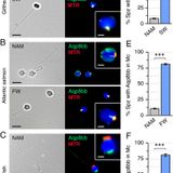 A multiplier peroxiporin signal transduction pathway powers piscine spermatozoa