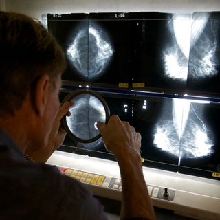 COVID-19 vaccine causing swelling that’s showing up on mammograms