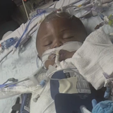 Part of baby's skull removed after officer accidentally shot child