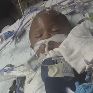 Part of baby's skull removed after officer accidentally shot child