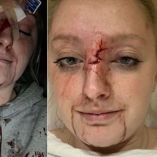 Lawsuit: Minneapolis police shot driver with projectile, knocked her out at wheel