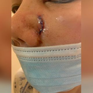 ‘I’m scared to go out’: Woman hit in face with metal pipe in latest Manhattan hate crime