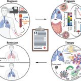 The microbiome and human cancer