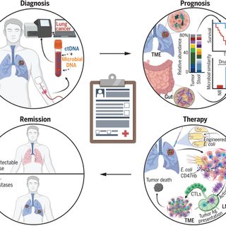 The microbiome and human cancer