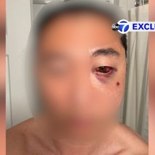 Exclusive: Man with wife and 5-year-old son attacked in Central Park