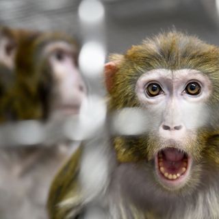 Neuralink’s Monkey Experiment Raises Questions From Scientists and Tech Ethicist