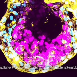 What’s next for lab-grown human embryos?