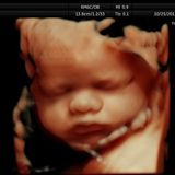 Georgia Judge Won't Block Abortion Ban, Law Will Keep Saving Babies From Abortions - LifeNews.com