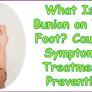 What Is a Bunion on Your Foot? Causes, Symptoms, Treatment, Prevention