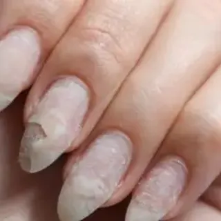 Why Do My Acrylic Nails Keep Popping Off? Top 13 Reasons