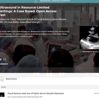 #TB #Pericarditis and the new eBook for #POCUS #Ultrasound in limited resource settings! #foamed #foamus @ucdavisem @escholarship @danmirsch @globalhealth