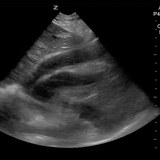 Shock Cases for #meded #POCUS #FOAMus #FOAMed