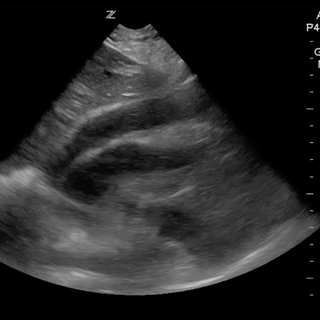 Shock Cases for #meded #POCUS #FOAMus #FOAMed