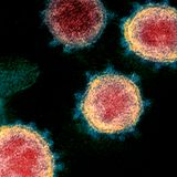 Dallas County reports 186 coronavirus cases, 5 deaths; 4 children treated in Fort Worth for rare syndrome connected to COVID-19