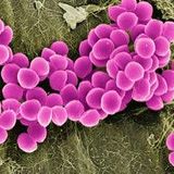 Superbugs may be here to stay