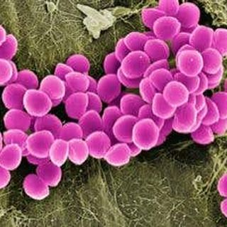 Superbugs may be here to stay